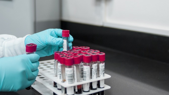 Governo catalão publica os dados de testes de coronavírus feitos